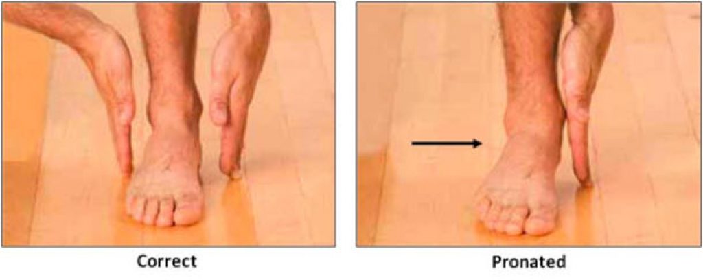 Правильные стопы ног. Плоскостопие пронация стопы. Стопы при правильной походке. Правильная постановка ступни при ходьбе. Стопа - правильная походка.